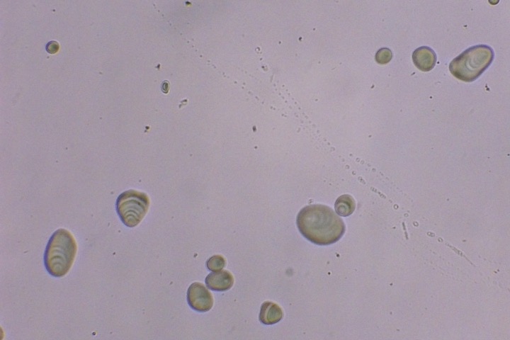 Amidon de pomme de terre