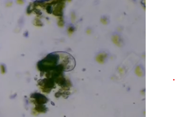 Vidéo de protozoaire au microscope