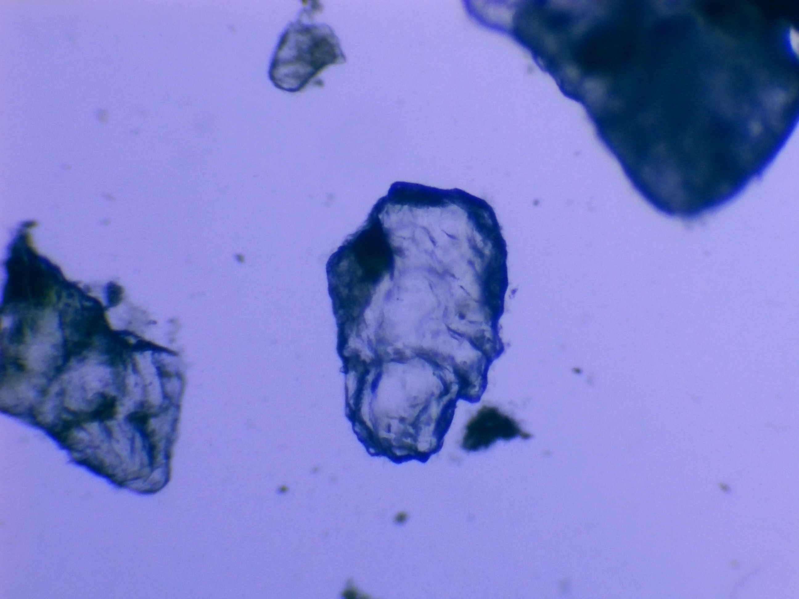 Kyste de protozoaire