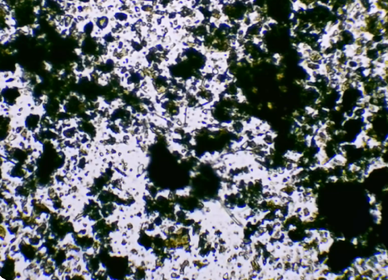 Vidéo de petit nematode au microscope