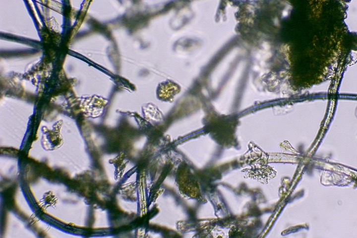 Poussière au microscope