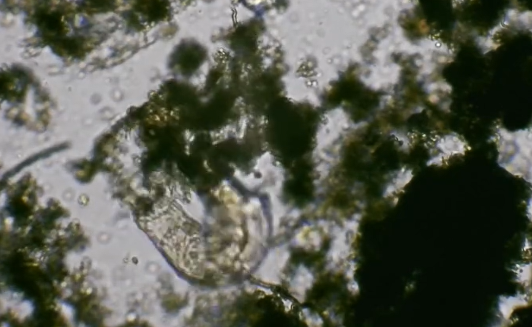 Vidéo de rotifere au microscope