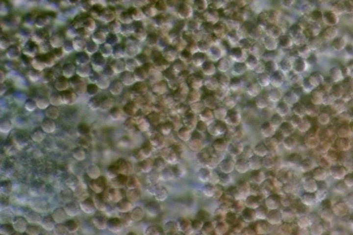 Sang humain au microscope